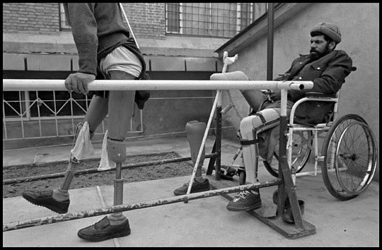 Afghanistan, 1996 - Land mine victims learned to walk on prosthetic legs at ICRC clinic.