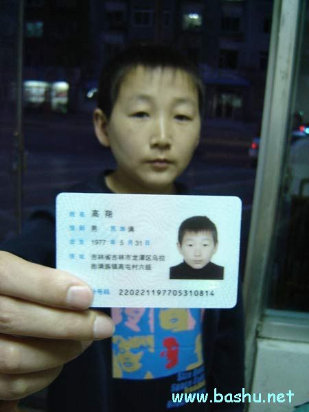 30岁男子13岁相貌 发育迟缓苦寻病因 30岁男子13岁相貌 发育迟缓苦寻病因